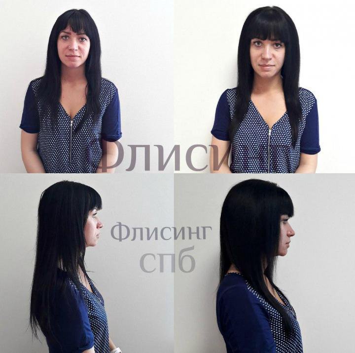 Что Такое Флисинг Для Волос Фото – Telegraph