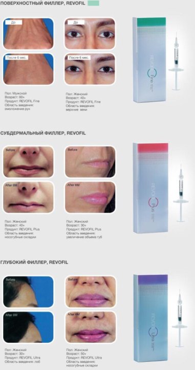 Fillers Ru Интернет Магазин Екатеринбург