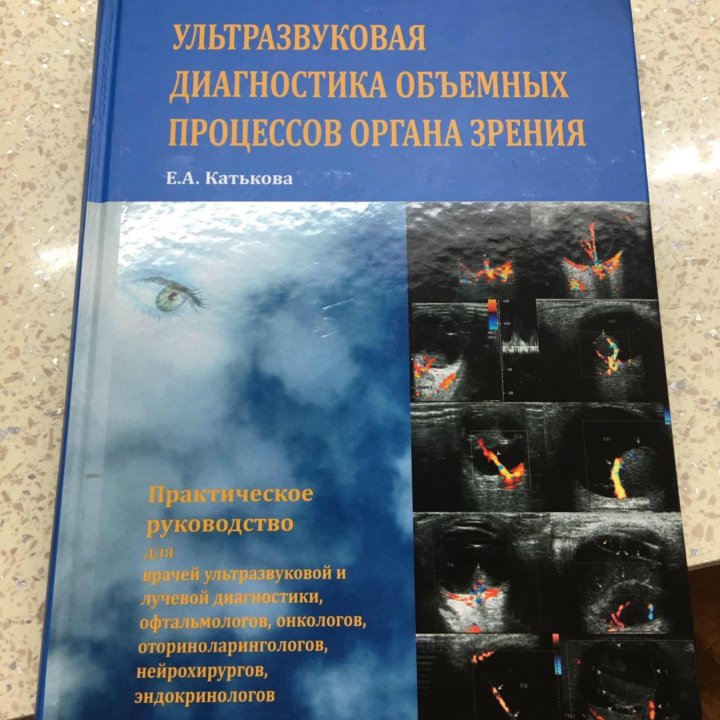 УЗД ОБЬЕМНЫХ ОБРАЗОВАНИЙ ОРГАНОВ ЗРЕНИЯ