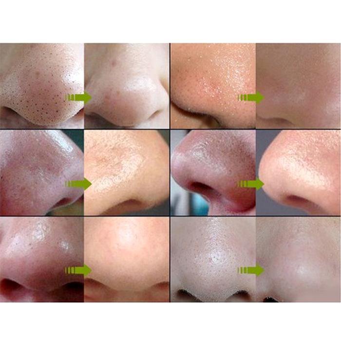 Pore six footage — photo 3