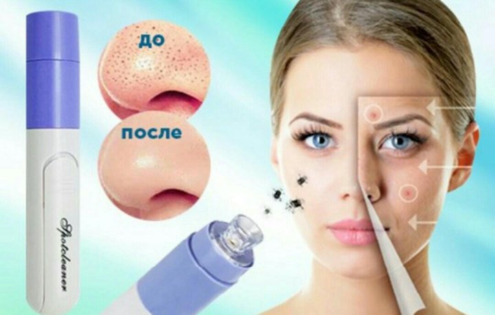 Spot cleaner вакуумный очиститель пор для лица. Spot cleaner вакуумный очиститель пор для лица. Spot cleaner - очиститель пор для лица 1. Вакуумный очиститель пор. Вакуумный очиститель для лица.