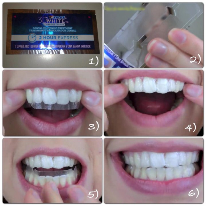 Зуб отбеливание пить. Пластинки для отбеливания зубов. Отбеливающие полоски для зубов. Отбеливающие полоски для зубов до и после. Полоски для отбеливания зубов до и после.