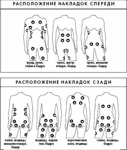 Правильное расположение электродов при миостимуляции