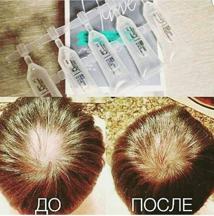 Сыворотка для волос из грибов