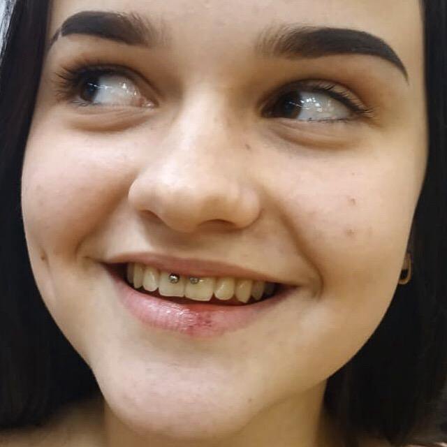 Прокол кристина фото