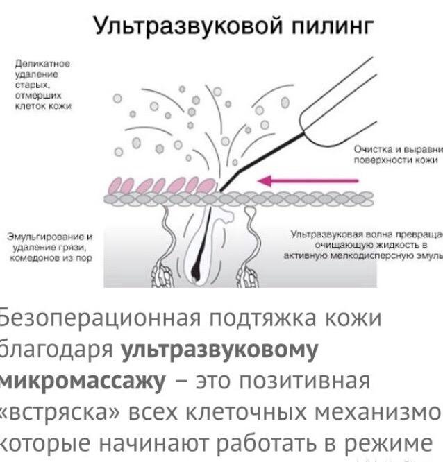 Схема ультразвуковой чистки лица в домашних условиях