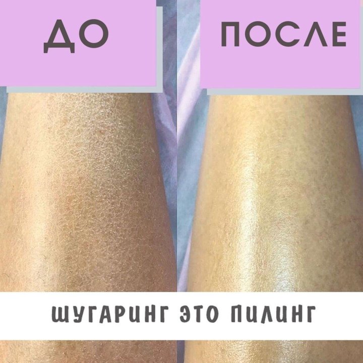Шугаринг омск
