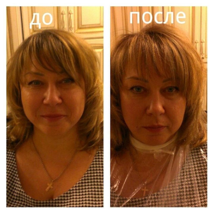 Прикорневая химия для объема волос фото до и после на средние волосы