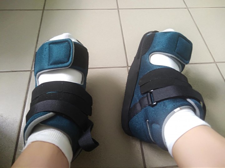 Ортопедическая обувь после операции на косточках для женщин