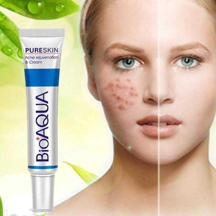 Анти акне до и после отзывы Bioaqua крем для проблемной кожи - купить в Удельной, цена 150 руб., продано 9 ф