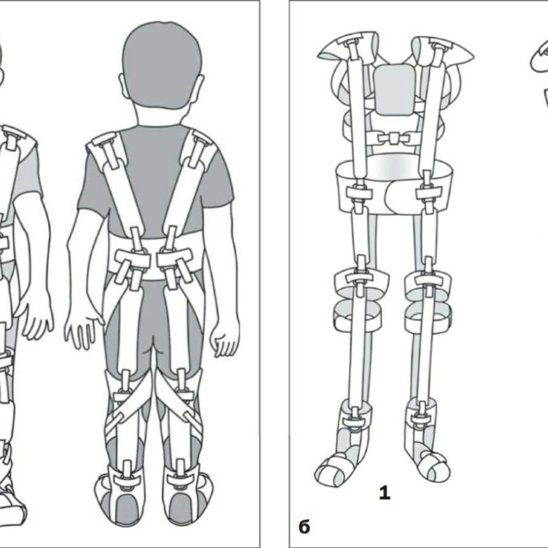 Julius exoskeleton