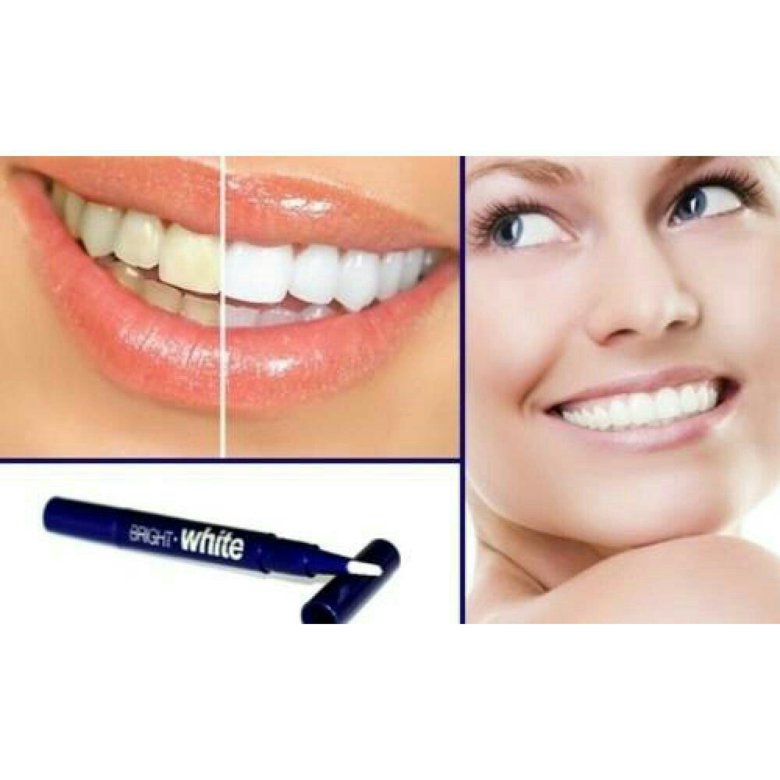 Bright White для домашнего отбеливания зубов в Нижнекамске
