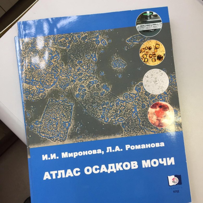 Атлас осадков. Миронова Романова атлас. Атлас осадков мочи Миронова. Атлас осадка мочи. Атлас мочевого осадка.