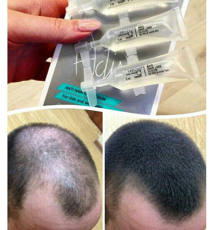 Сыворотка для волос из грибов
