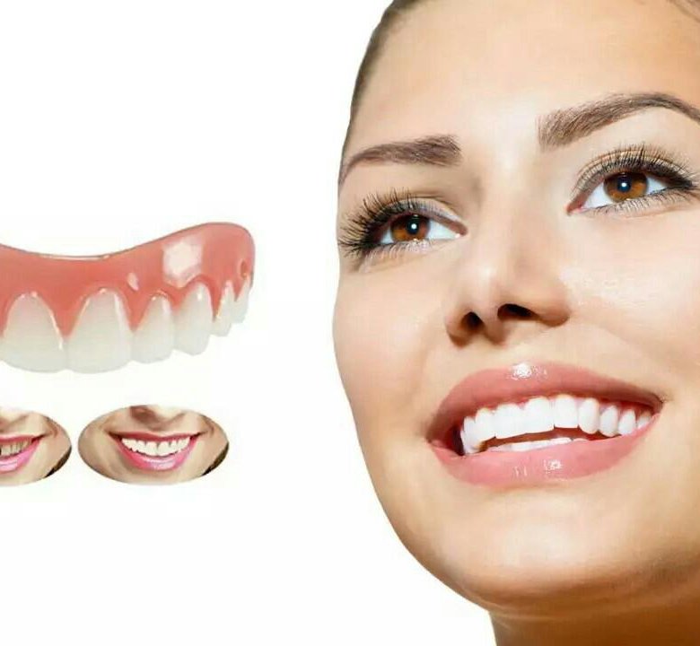 Perfect smile. Перфект Смайл виниры. Виниры для зубов. Виниры Перфект Смайл для зубов. Съемные виниры perfect smile.