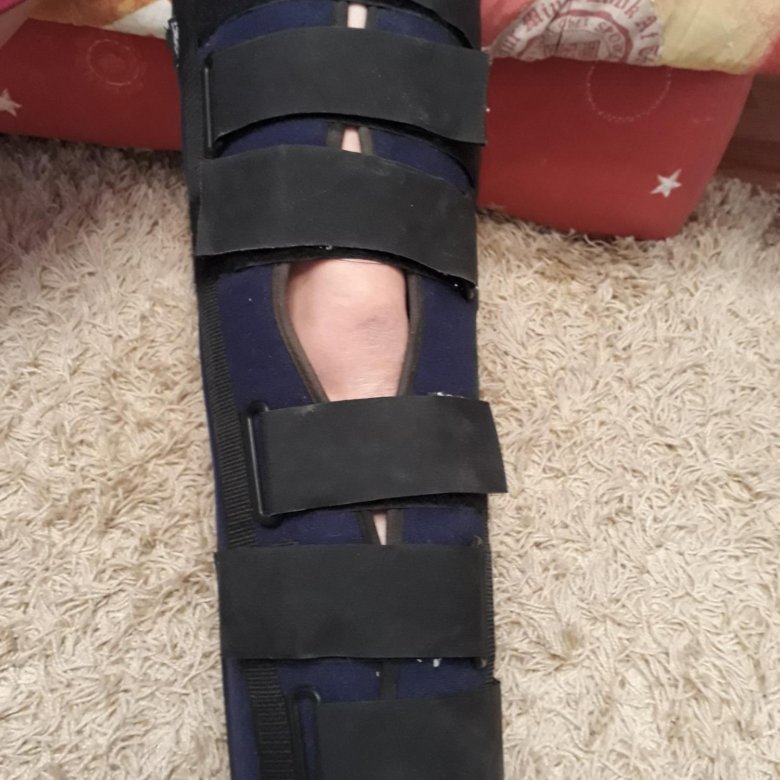 тутор коленного сустава skn 401. тутор коленного сустава skn 401. тутор коленного сустава skn 401. тутор skn 401. тутор орто skn 401.